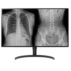 Màn hình hiển thị Y tế 32HL512D-B